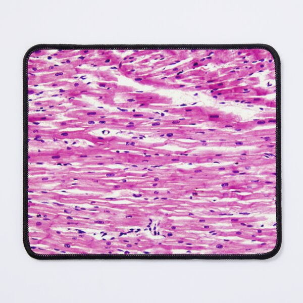 Item preview, Myocardial Tissue designed and sold by DarkiraVClemm.