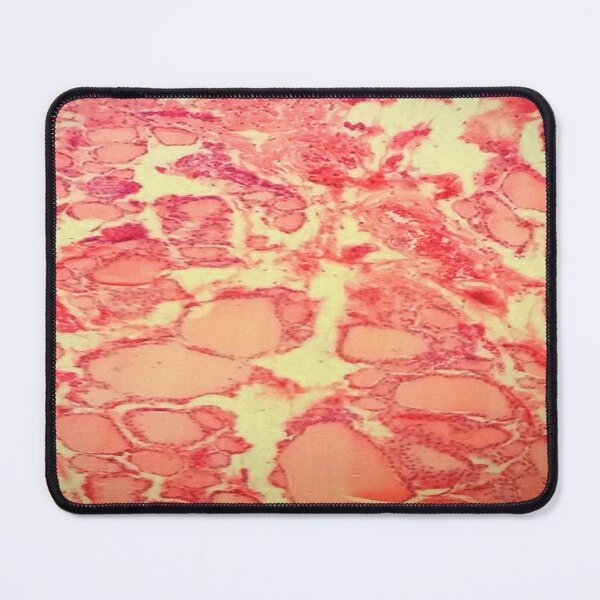 Item preview, Thyroid tissue designed and sold by DarkiraVClemm.