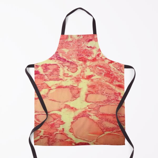 Item preview, Thyroid tissue designed and sold by DarkiraVClemm.