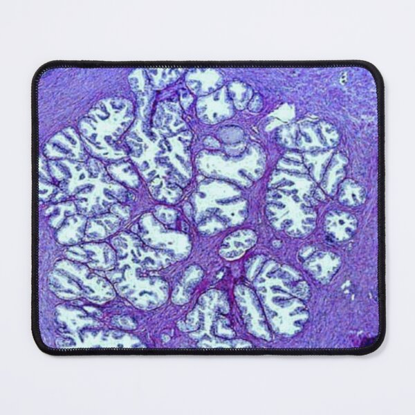 Item preview, Prostata tissue designed and sold by DarkiraVClemm.