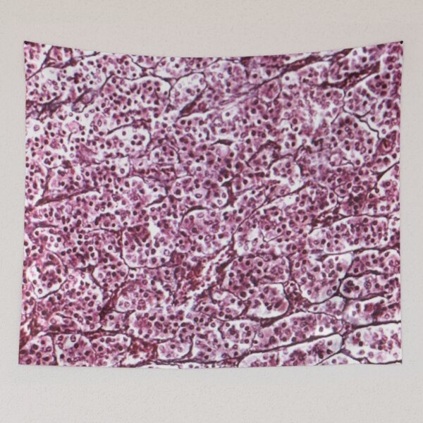 Item preview, Reticular fibers designed and sold by DarkiraVClemm.