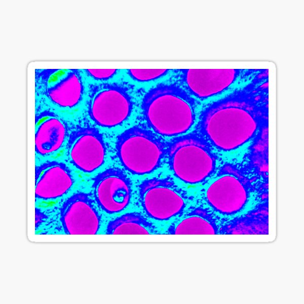 Small lakes Sticker