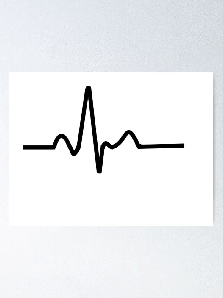 ECG Trace