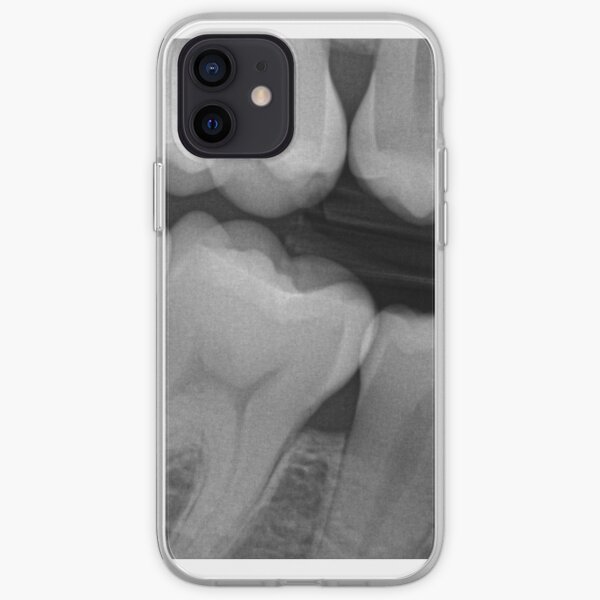 El otro lado Funda blanda para iPhone