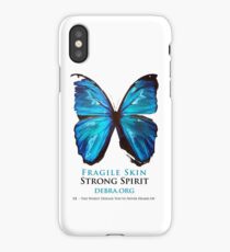 Beautiful Blue Butterfly Proceeds donated to DebRa.org iPhone Case/Skin