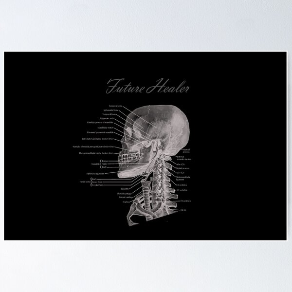Item preview.
