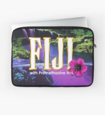 Lila Traum Laptoptasche