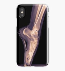 x-ray of a ballet dancer standing on pointe iPhone Case