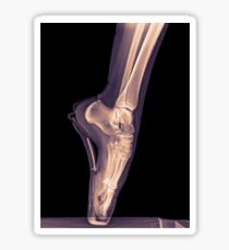 x-ray of a ballet dancer standing on pointe Sticker