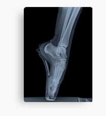 Lienzo x-ray of a ballet dancer standing on pointe