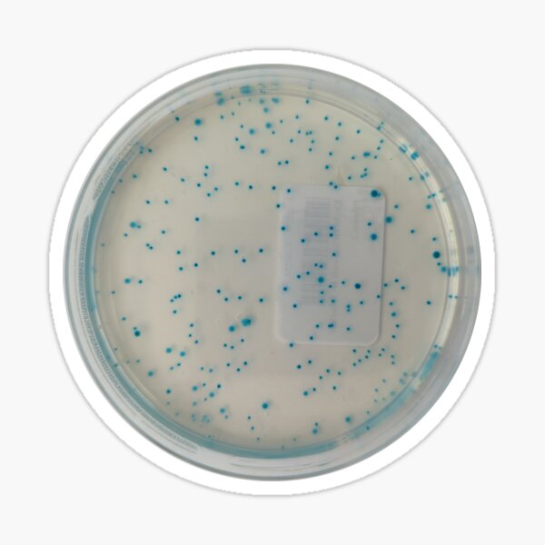 Vista previa del artículo con la obra «E.coli en placa TBX», diseñado y vendido por Fromthelab.