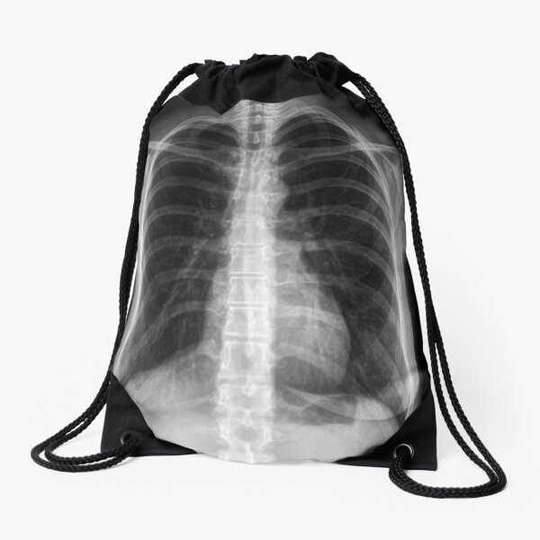 X Ray Drawstring Bag