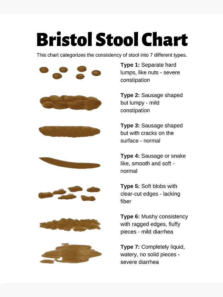 Cary Gastroenterology Associates  The Bristol Stool Chart: What Type…