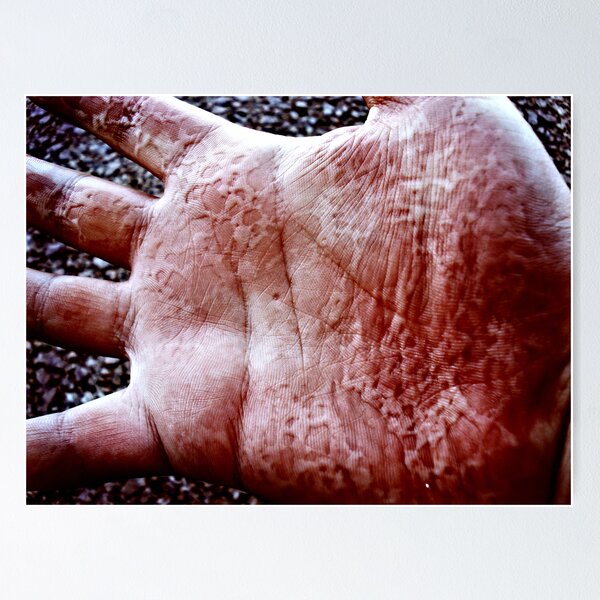 Item preview, Need a Helping Hand? designed and sold by Nathan T.