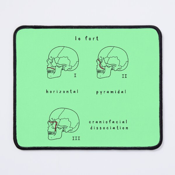 Item preview, Hand Drawn Le Fort Facial Fractures Sagittal Plane designed and sold by SofiaSava01.
