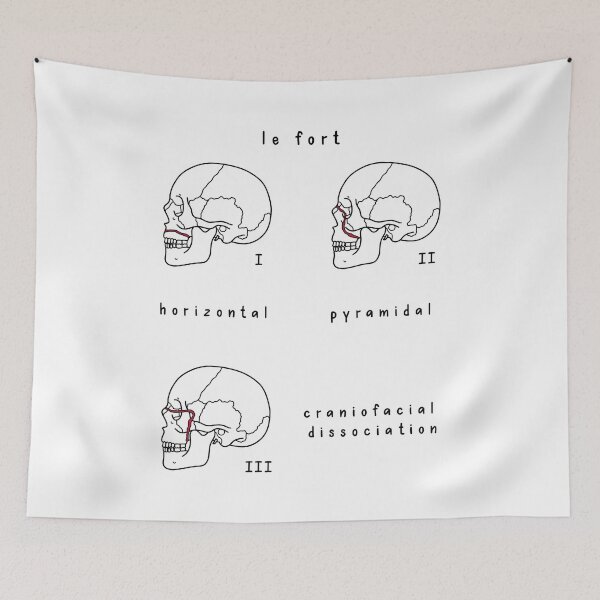 Item preview, Hand Drawn Le Fort Facial Fractures Sagittal Plane designed and sold by SofiaSava01.