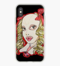Little Miss iPhone Case