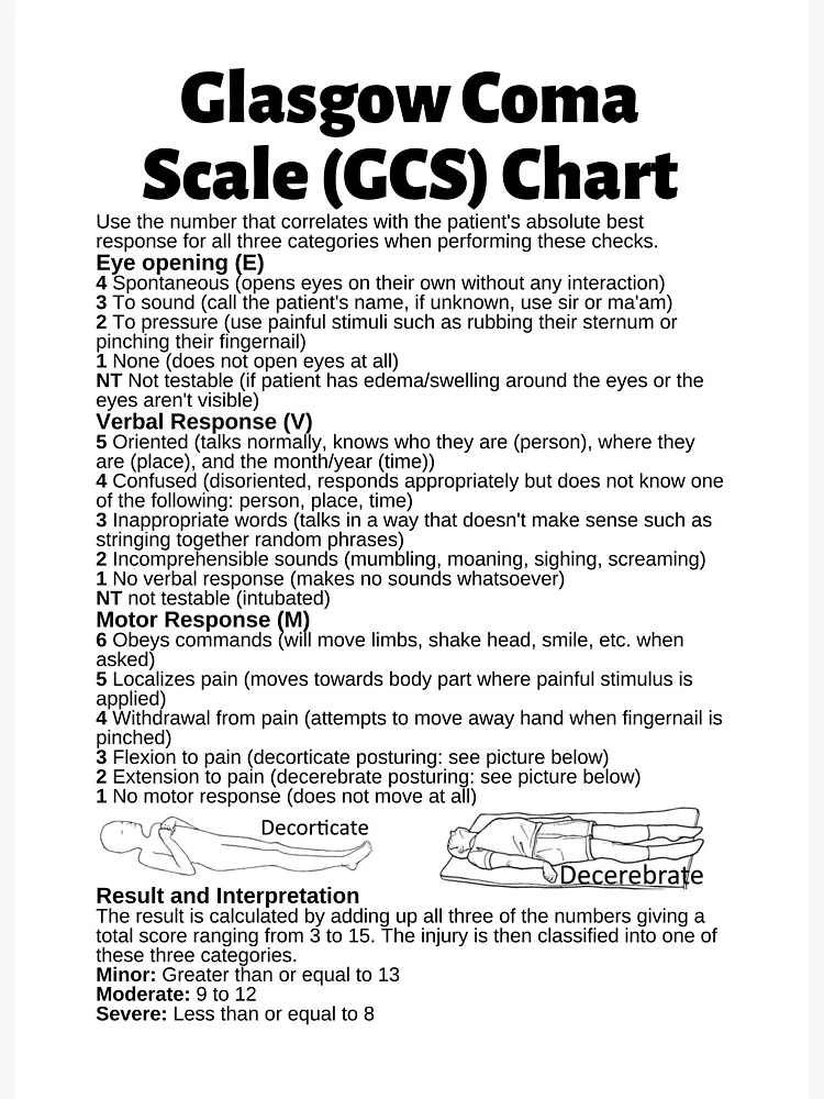 Glasgow Coma Scale (GCS) Print Home Fine Art Print