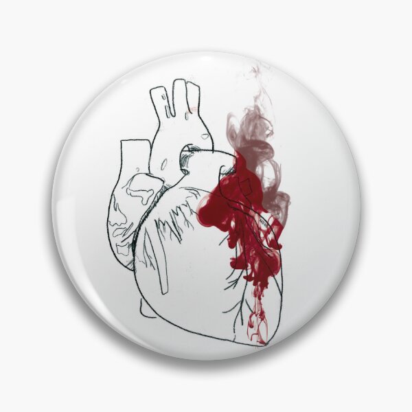 Item preview.
