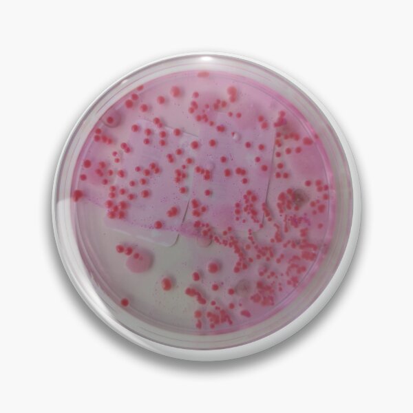 Item preview, Yeasts growing on DRBCA designed and sold by Fromthelab.