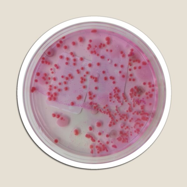 Item preview, Yeasts growing on DRBCA designed and sold by Fromthelab.
