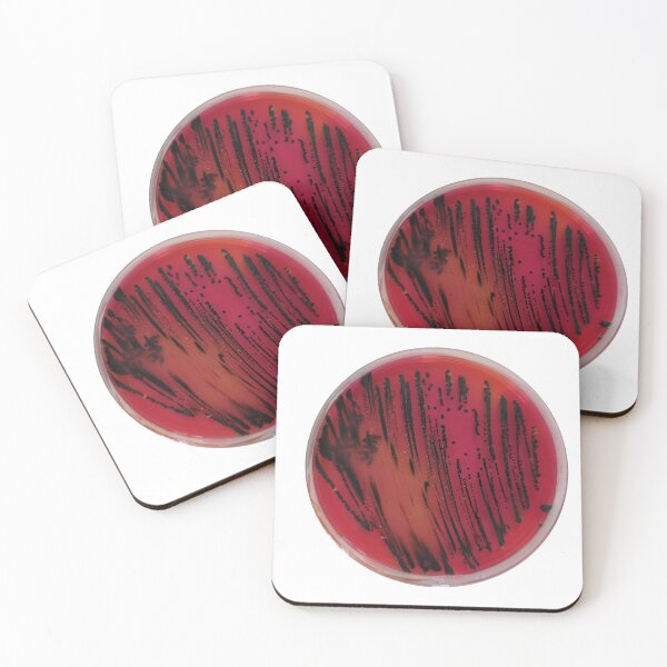 Item preview, Salmonella on XLD designed and sold by Fromthelab.