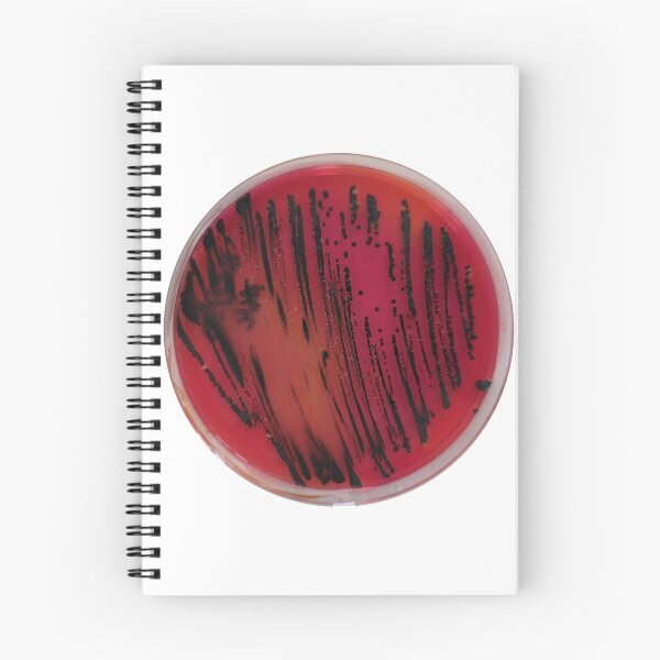Item preview, Salmonella on XLD designed and sold by Fromthelab.