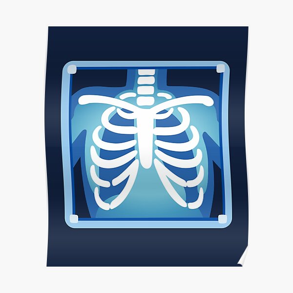 Funny X Ray Posters for Sale | Redbubble Funny X Ray Posters for Sale | Redbubble
