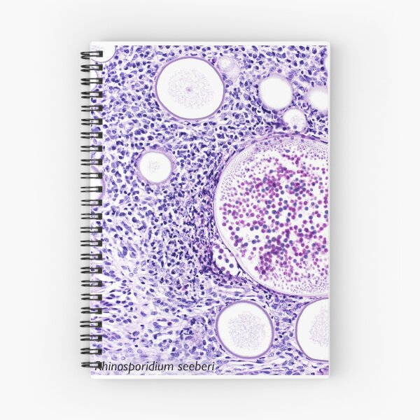 Item preview, Rhinosporidium seeberi designed and sold by Bobbi Pritt.