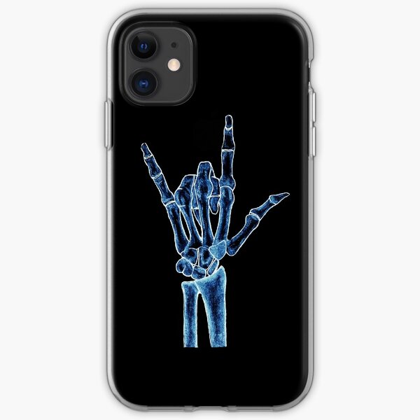 Xray Gifts & Merchandise | Redbubble