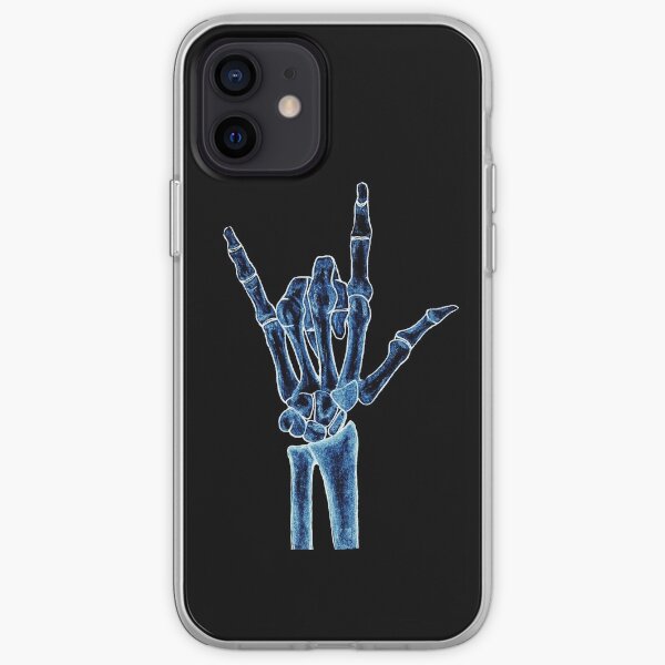 X-ray iPhone Soft Case