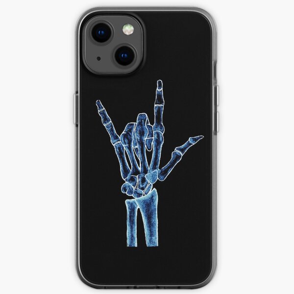X-ray iPhone Soft Case