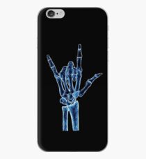 X-ray iPhone Case