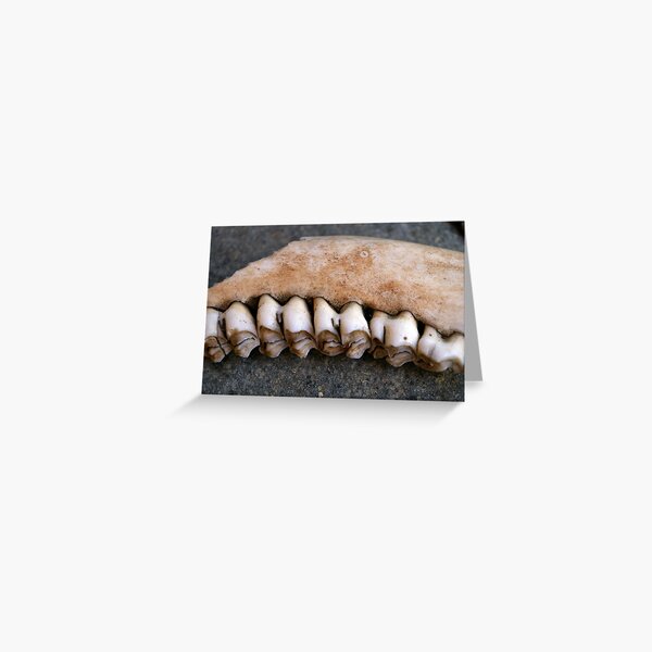 Teeth Greeting Card