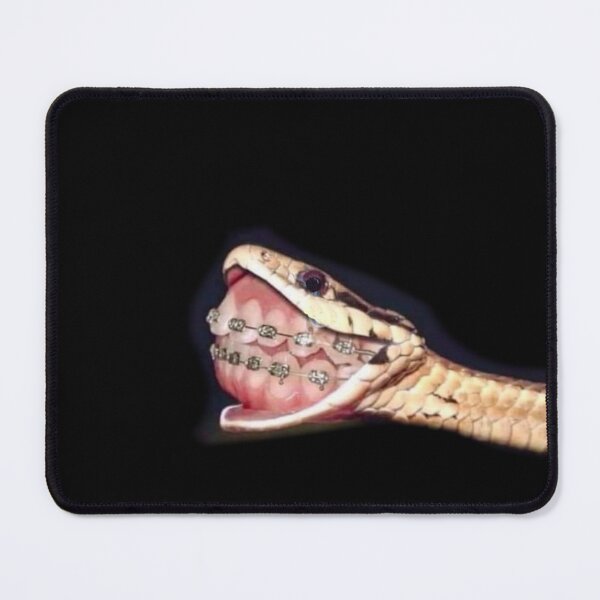 Item preview, Braces designed and sold by Yabya.