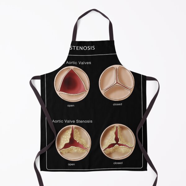 Item preview, Medical Illustration of Heart Valves, Normal & Stenosis designed and sold by ScienceSource.