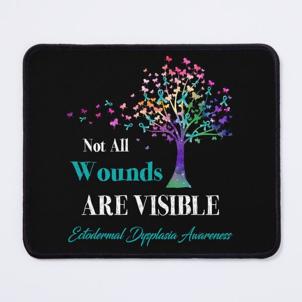 Item preview, Not All Wounds Are Visible Ectodermal Dysplasia Awareness designed and sold by Hatjar.