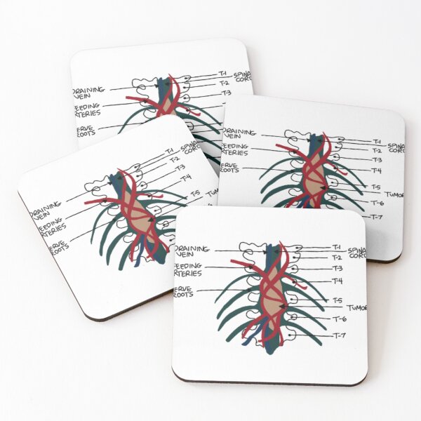 Item preview, Tumor on the wall designed and sold by emm416.