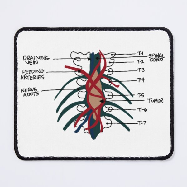 Item preview, Tumor on the wall designed and sold by emm416.