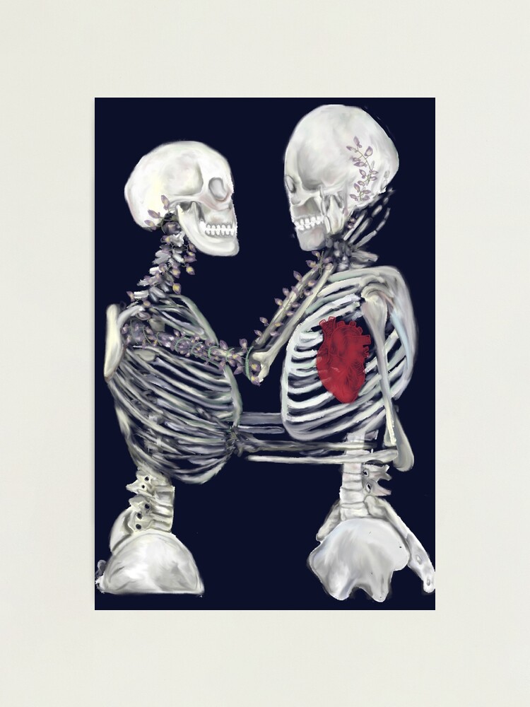 Smothered in Hugs Skeletons | Sticker