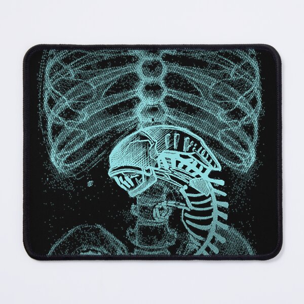 Item preview, Alien Radiography X-Ray  designed and sold by WayneBol.