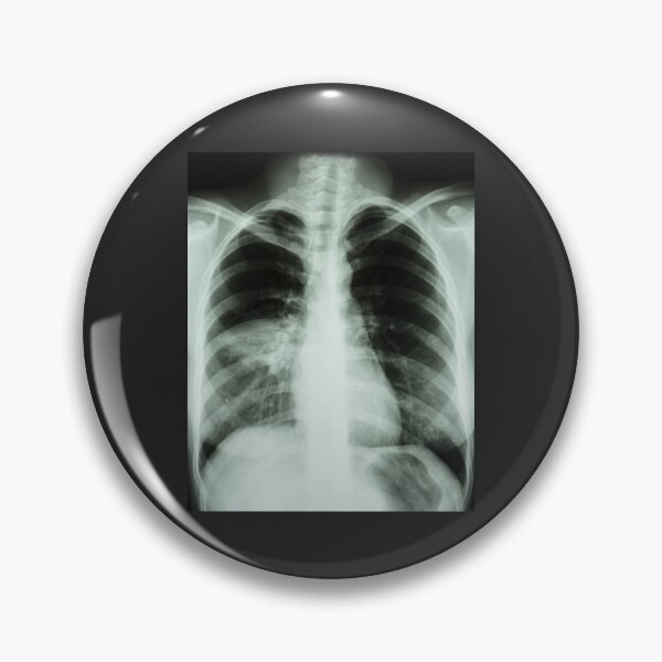 Item preview, X-rays designed and sold by GabyDark.