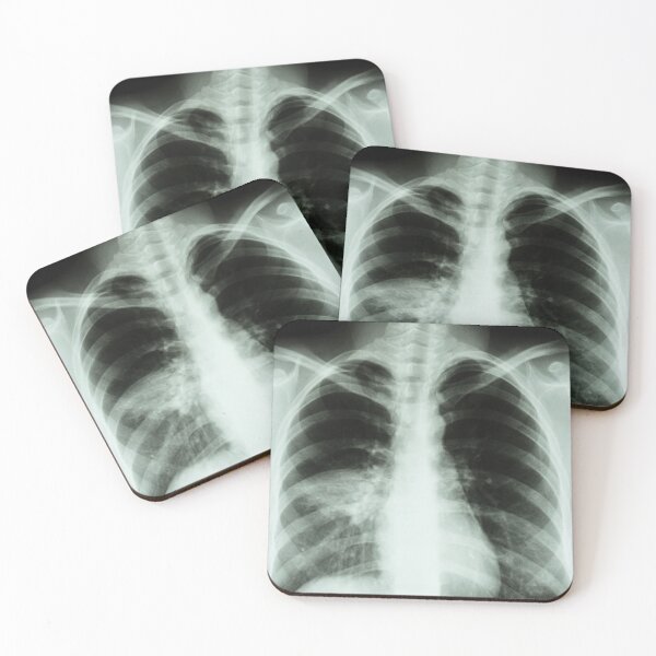 Item preview, X-rays designed and sold by GabyDark.