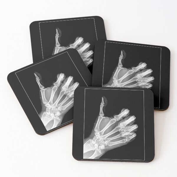 Item preview, x-ray (hand) designed and sold by GabyDark.