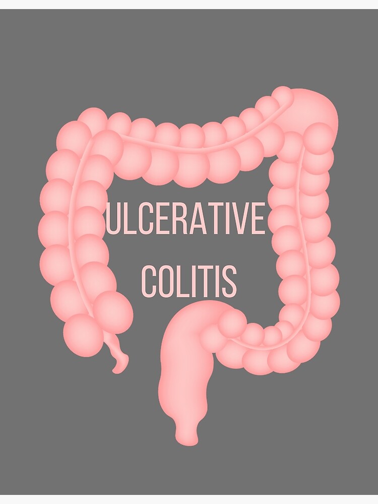 "ulcerative colitis" Poster for Sale by AyahBaniMustafa Redbubble