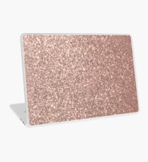 Pink Rose Gold Metallic Glitter Laptop Skin