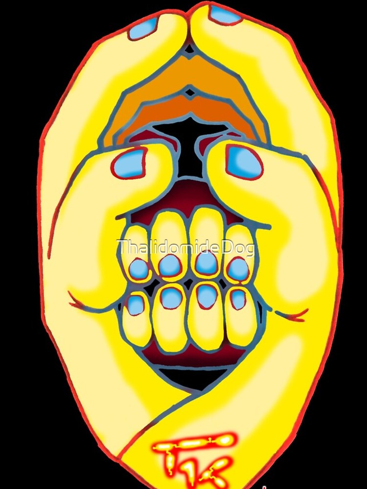 Thumbnail 4 of 4, iPhone Case, Hand Head designed and sold by ThalidomideDog.