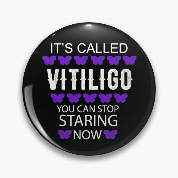 Item preview, It's called Vitiligo you can stop staring now - Vitiligo Raise Awareness   designed and sold by Raiko-art.