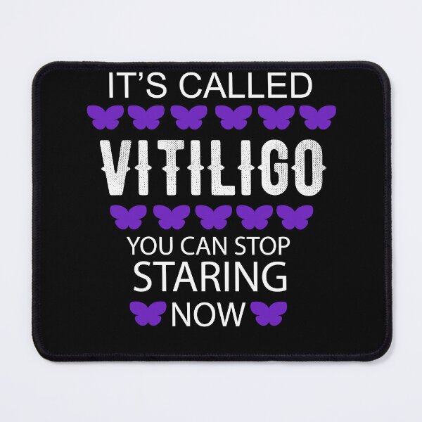 Item preview, It's called Vitiligo you can stop staring now - Vitiligo Raise Awareness designed and sold by Raiko-art.