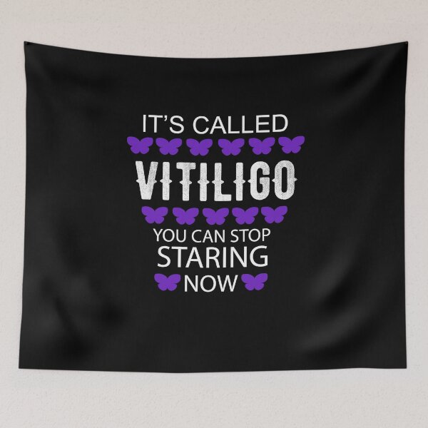 Item preview, It's called Vitiligo you can stop staring now - Vitiligo Raise Awareness   designed and sold by Raiko-art.